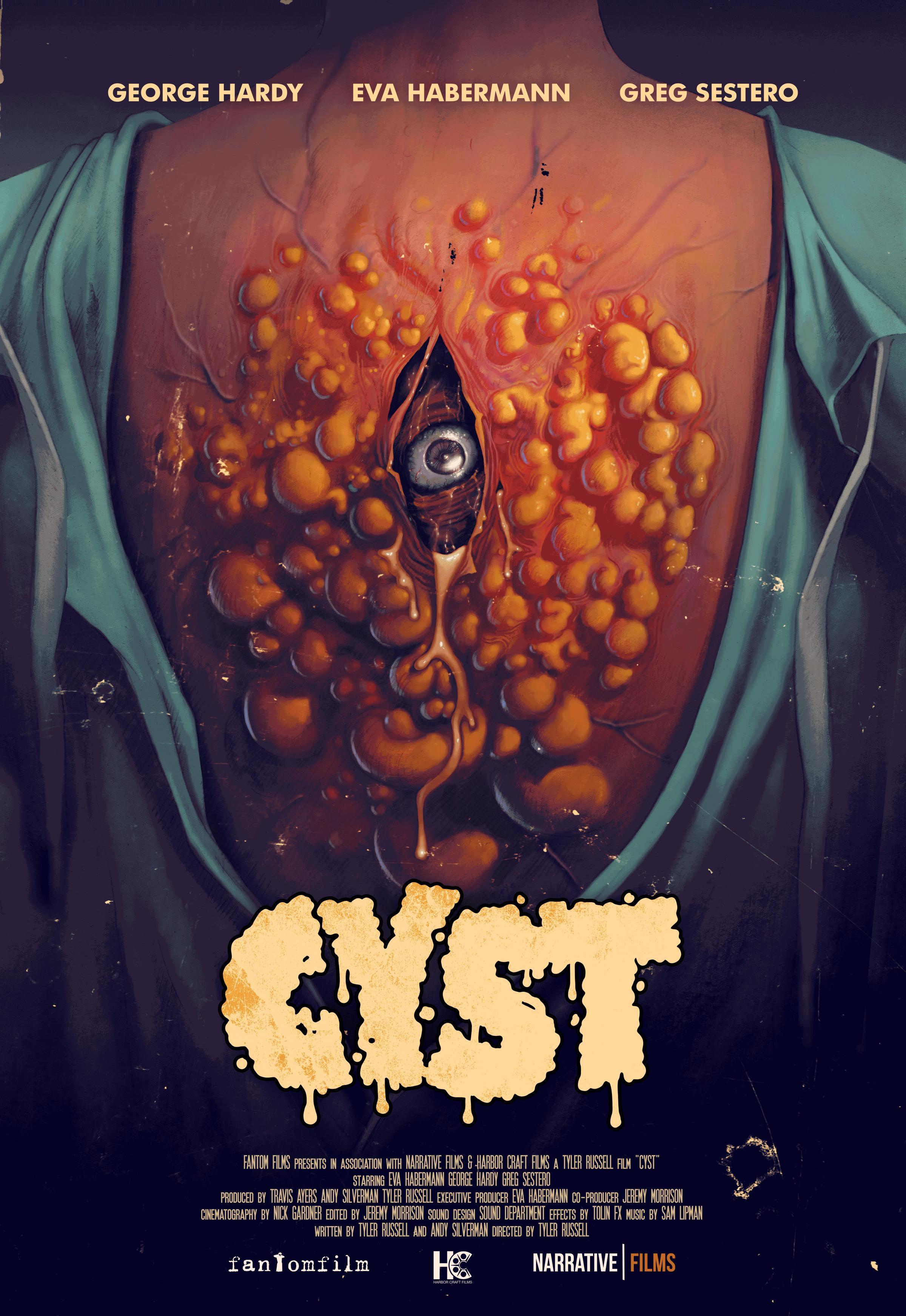 Постер фильма Киста | Cyst